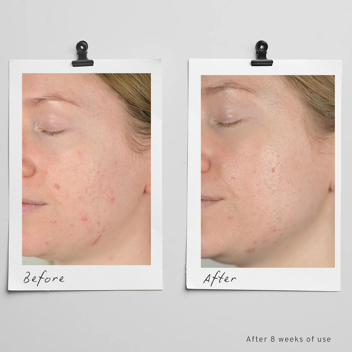 Skinome Azeretinal Concentrate näokontsentraat 30 ml – pilt 2